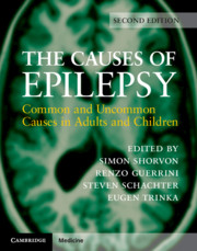 Causes of Epilepsy, 2nd ed.- Common & Uncommon Causes in Adults & Children