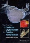 Practice of Catheter Cryoablation for CardiacArrhythmias