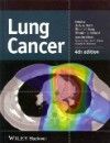 Lung Cancer, 4th ed.