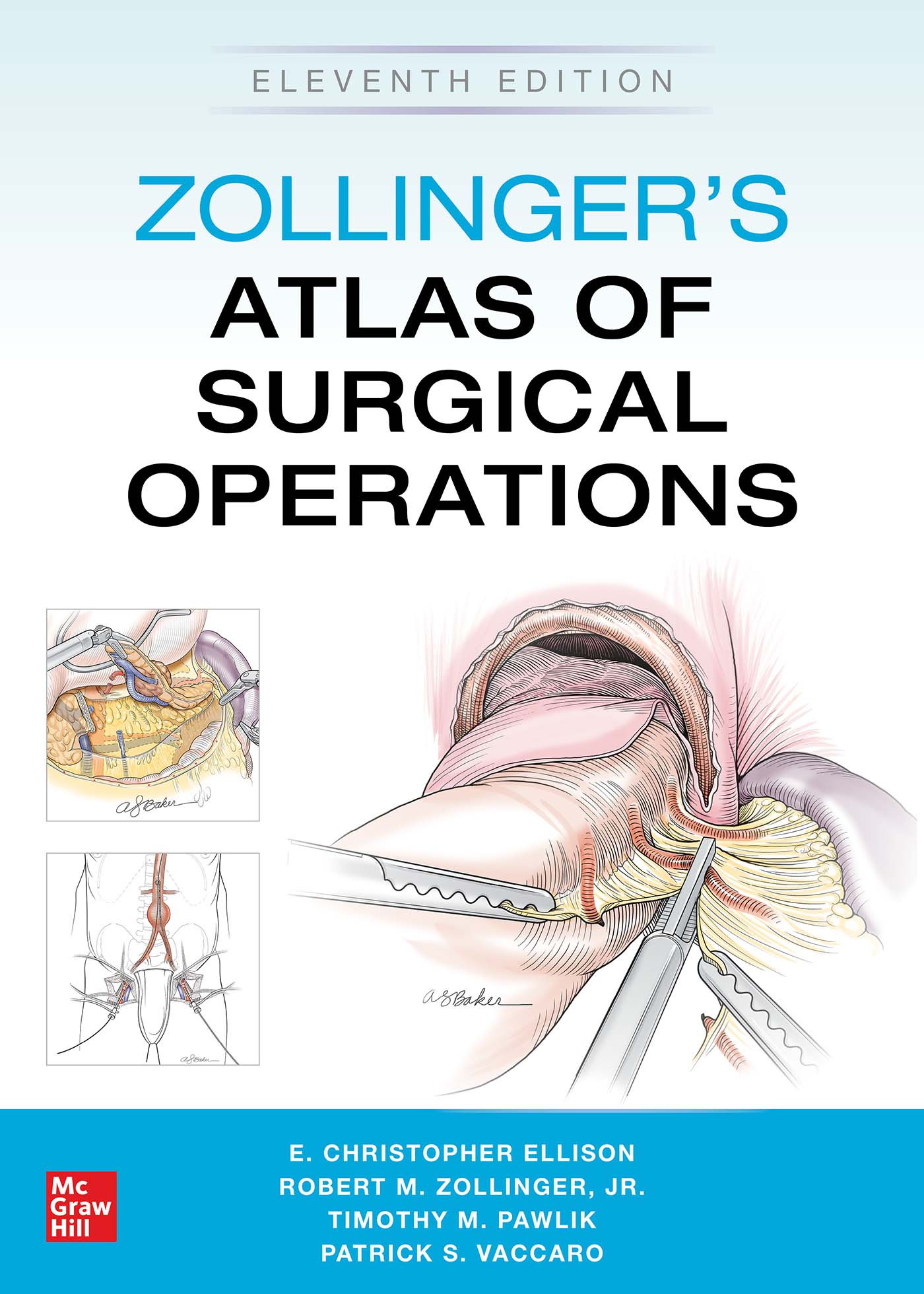 Zollinger's Atlas of Surgical Operations, 11th ed.