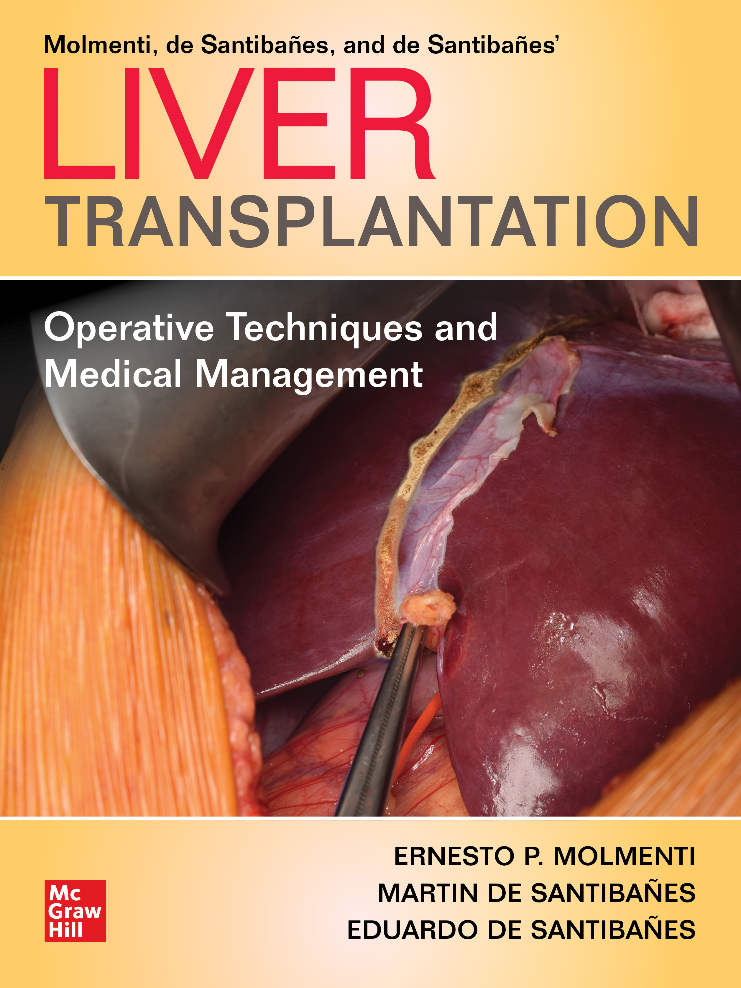 Liver TransplantationOperative Techniques & Medical Management