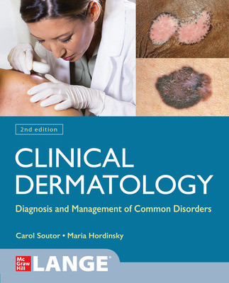 Clinical Dermatology, 2nd ed.-Diagnosis & Managment of Common Disorders