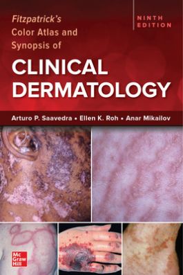 Fitzpatrick's Color Atlas & Synopsis of ClinicalDermatology, 9th ed.