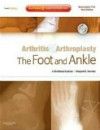 Arthritis & Arthroplasty: Foot & AnkleWith DVD
