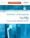 Arthritis & Arthroplasty: Hip, with DVD