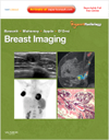 Breast Imaging(Expert Radiology Series)