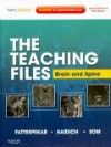 Teaching Files: Brain & Spine Imaging