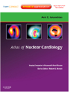 Atlas of Nuclear Cardiology- Imaging Companion to Braunwald's Heart