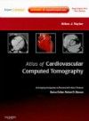 Atlas of Cardiovascular Computed Tomography with ExpertWith Expert Consult
