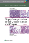 Biopsy Interpretation of Uterine Cervix & Corpus,2nd ed.