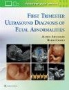 First Trimester Ultrasound Diagnosis of FetalAbnormalities