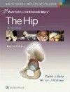 Hip, 3rd ed.(Master Techniques in Orthopaedic Surgery)