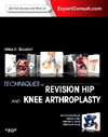 Techniques in Revision Hip & Knee Arthroplasty