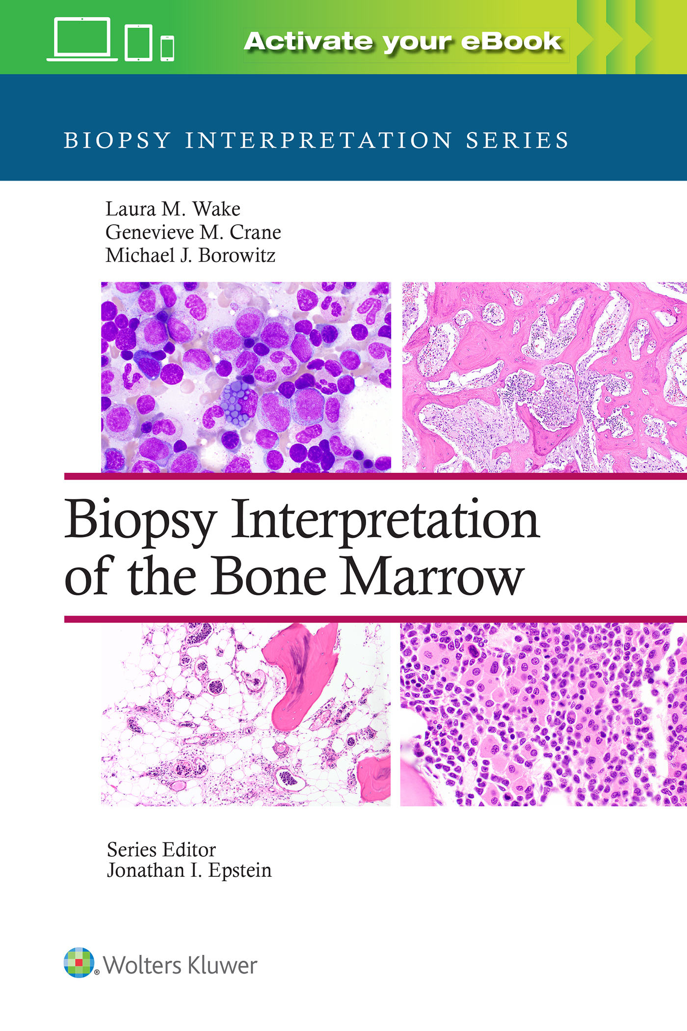 Biopsy Interpretation of Bone Marrow(Biopsy Interpretation Series)