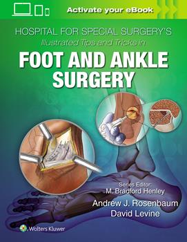 Hospital for Special Surgery's Illustrated Tips &Tricks in Foot & Ankle Surgery