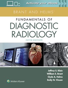 Brant & Helms's Fundamentals of Diagnostic Radiology,5th ed.
