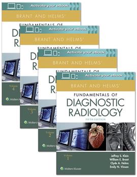 Brant & Helms's Fundamentals of Diagnostic Radiology,5th ed., Paperback in 4vols