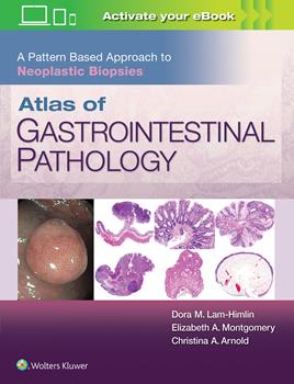 Atlas of Gastrointestinal Pathology- A Pattern Based Approach to Neoplastic Biopsies