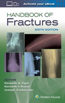Handbook of Fractures, 6th ed.