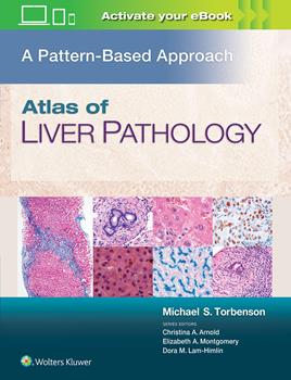 Atlas of Liver Pathology- Pattern Based Approach