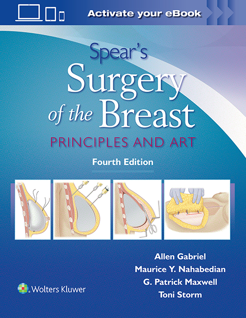 Spear's Surgery of the Breast, 4th ed.,- Principles & Art