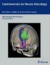Controversies in Neuro-Oncology- Best Evidence Medicine for Brain Tumor Surgery