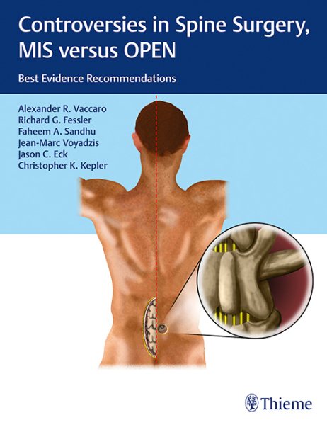 Controversies in Spine Surgery: Mis Versus Open- Best Evidence Recommendations