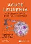 Acute Leukemia- An Illustrated Guide to Diagnosis & Treatment