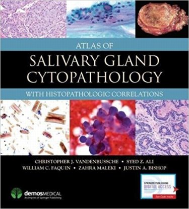 Atlas of Salivary Gland CytopathologyWith Histopathologic Correlations