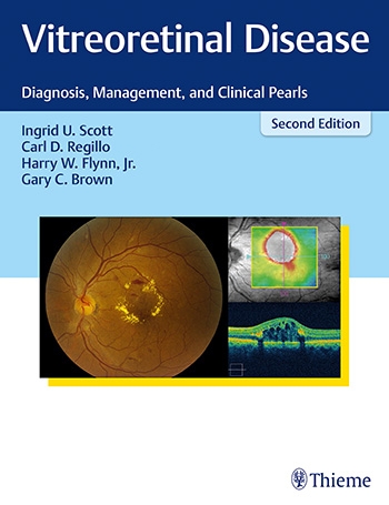 Vitreoretinal Disease, 2nd ed.- Diagnosis, Management & Clinical Pearls