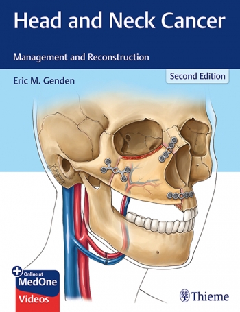 Head & Neck Cancer, 2nd ed.- Management & Reconstruction