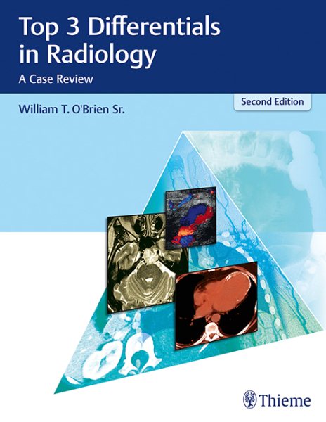 Top 3 Differentials in Radiology, 2nd ed.- Case Review