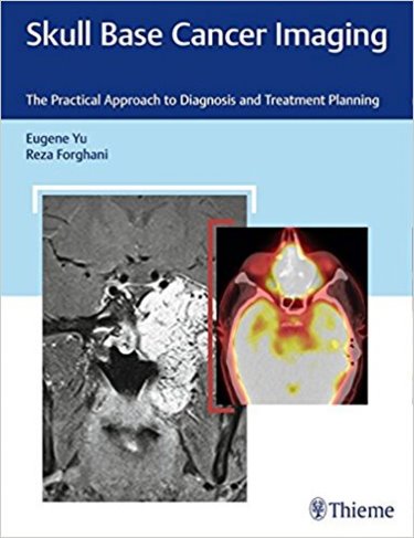 Skull Base Cancer Imaging- Practical Approach to Diagnosis & Treatment Planning