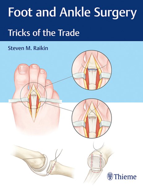 Foot & Ankle Surgery- Tricks of the Trade
