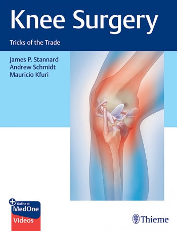 Knee Surgery- Tricks of the Trade