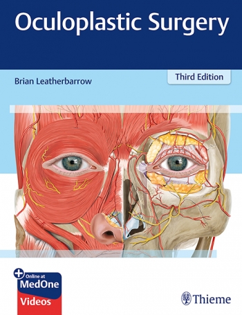 Oculoplastic Surgery, 3rd ed.