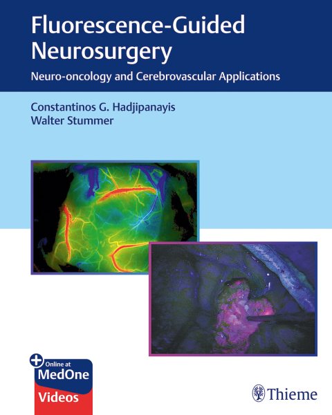 Fluorescence-Guided Neurosurgery- Neuro-Oncology & Cerebrovascular Applications