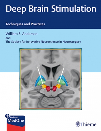 Deep Brain StimulationTechniques & Practices