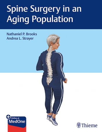 Spine Surgery in Aging Population
