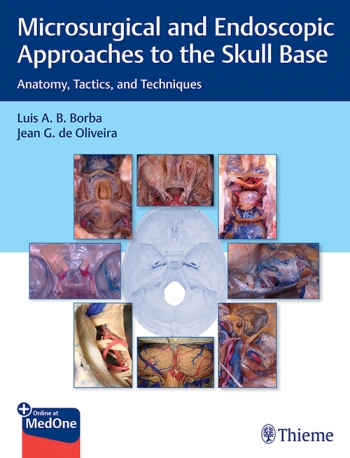 Microsurgical & Endoscopic Approaches to Skull Base