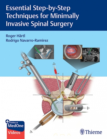 Essential Step-By-Step Techniques for MinimallyInvasive Spinal Surgery