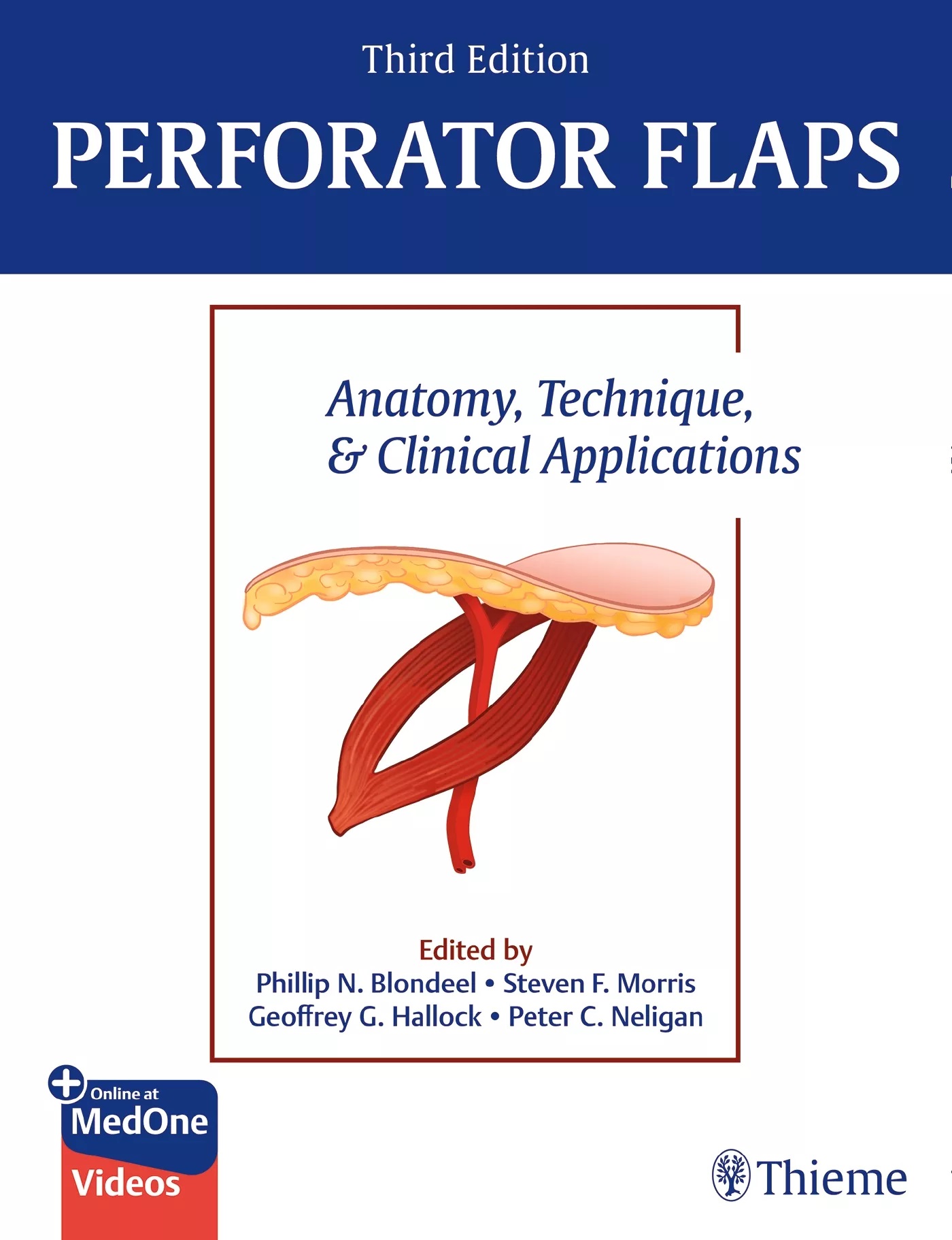 Perforator Flaps, 3rd ed.- Anatomy, Technique & Clinical Applications