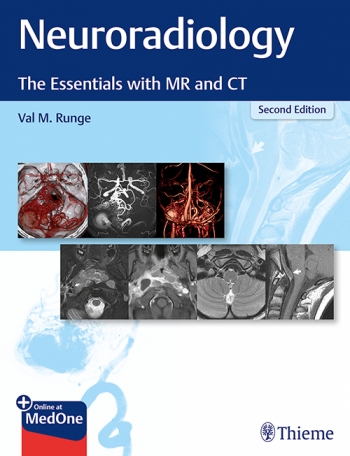 Neuroradiology, 2nd ed.- The Essentials with MR & CT
