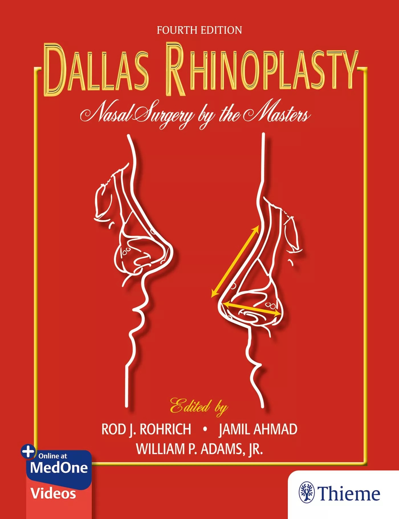 Dallas Rhinoplasty, 4th ed.- Nasal Surgery by the Masters