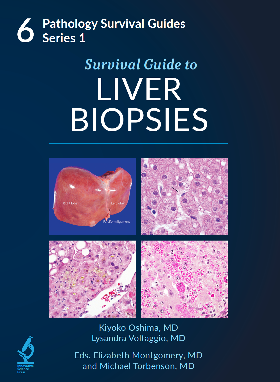 Pathology Survival Guides, Series 1Vol.6: Survival Guide to Liver Biopsies