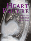 Colour Handbook: Heart Failure, Hardcover- Investigation, Diagnosis, Treatment