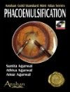Mini Atlas of Phacoemulsification (With Mini CD-ROM)