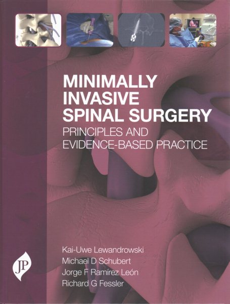 Minimally Invasive Spine Surgery- Principles & Evidence-Based Practice