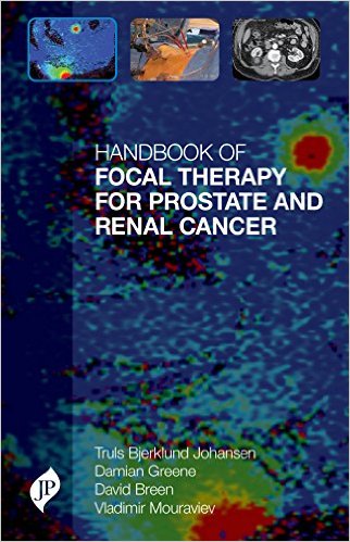 Handbook of Focal Therapy for Prostate & Renal Cancer