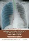 Unofficial Guide to Radiology- 100 Practice Chest X-Rays, with Full Colour